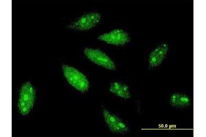 Immunofluorescence of monoclonal antibody to TRIM56 on HeLa cell.