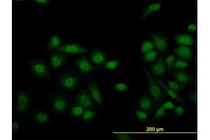 Image no. 1 for anti-Lysine (K)-Specific Demethylase 5B (KDM5B) (AA 231-320) antibody (ABIN599151) (KDM5B Antikörper  (AA 231-320))