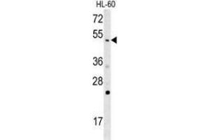 Western blot analysis in HL-60 cell line lysates (35ug/lane) using NOS1AP  Antibody . (NOS1AP Antikörper  (Middle Region))
