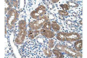 SOCS1 antibody was used for immunohistochemistry at a concentration of 4-8 ug/ml to stain Epithelial cells of renal tubule (arrows) in Human Kidney.