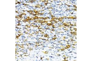 Immunohistochemistry of paraffin-embedded human tonsil using SNRNP70 antibody. (SNRNP70 Antikörper  (AA 150-250))