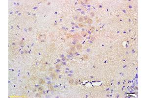 Formalin-fixed and paraffin embedded rat brain labeled with Anti-ATF6 Polyclonal Antibody, Unconjugated (ABIN732293) at 1:200 followed by conjugation to the secondary antibody and DAB staining