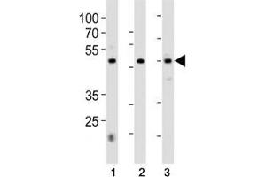 HNF4A antibody western blot analysis in 1) 293, 2) HepG2 cell line and 3) rat liver tissue lysate. (HNF4A Antikörper  (AA 281-312))