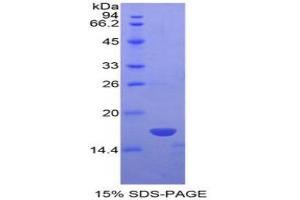 Non Metastatic Cells 4, Protein NM23A Expressed In protein