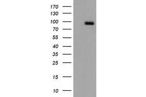 Western Blotting (WB) image for anti-CUB Domain Containing Protein 1 (CDCP1) antibody (ABIN1497413) (CDCP1 Antikörper)