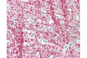 Anti-TPPP antibody IHC staining of human brain, cortex. (Tppp Antikörper  (AA 21-35))