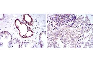 Immunohistochemistry (IHC) image for anti-Nuclear Factor of kappa Light Polypeptide Gene Enhancer in B-Cells 1 (NFKB1) antibody (ABIN969312)