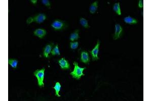 Immunofluorescent analysis of A549 cells using ABIN7146318 at dilution of 1:100 and Alexa Fluor 488-congugated AffiniPure Goat Anti-Rabbit IgG(H+L) (CCDC109B Antikörper  (Regulatory Subunit))