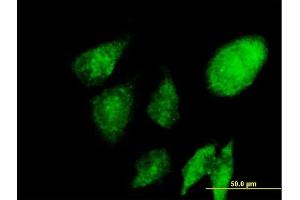 Immunofluorescence of purified MaxPab antibody to NACA on HeLa cell. (NACA Antikörper  (AA 1-215))