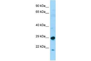 WB Suggested Anti-SPAG7 Antibody Titration: 1. (SPAG7 Antikörper  (N-Term))