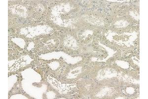 ABIN6258622 and ABIN6273497 at 1/100 staining human normal kidney tissue by IHC-P. (SIVA1 Antikörper  (Internal Region))
