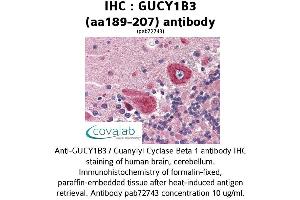 Image no. 1 for anti-Guanylate Cyclase 1, Soluble, beta 3 (GUCY1B3) (AA 189-207) antibody (ABIN2852385) (GUCY1B3 Antikörper  (AA 189-207))