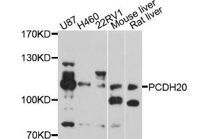 Western blot analysis of extracts of various cell lines, using PCDH20 antibody (ABIN5998470) at 1/1000 dilution. (PCDH20 Antikörper)