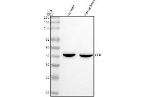 Western blot analysis of CCR1 using anti-CCR1 antibody (ABIN7602861).
