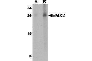 Western blot analysis of EMX2 in human lung tissue lysate with EMX2 antibody at (A) 1 and (B) 2 µg/mL. (EMX2 Antikörper  (Middle Region))