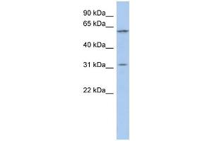 WB Suggested Anti-C1orf110 Antibody Titration: 0.