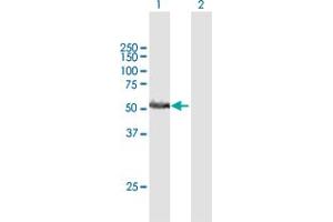 Western Blot analysis of RRP1 expression in transfected 293T cell line by RRP1 MaxPab polyclonal antibody. (RRP1 Antikörper  (AA 1-461))