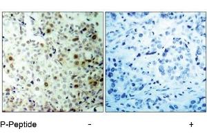 Image no. 1 for anti-Cyclin-Dependent Kinase 2 (CDK2) (pThr160) antibody (ABIN196844) (CDK2 Antikörper  (pThr160))