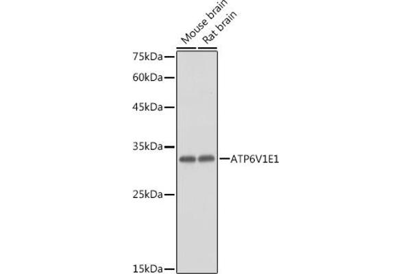 ATP6V1E1 Antikörper  (AA 77-226)