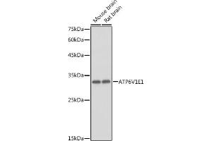 Western blot analysis of extracts of various cell lines, using V1E1 antibody (ABIN1678795, ABIN3018056, ABIN3018057 and ABIN6220346) at 1:1000 dilution. (ATP6V1E1 Antikörper  (AA 77-226))