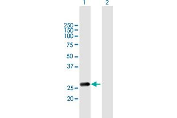 RAB20 Antikörper  (AA 1-234)