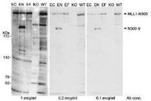 Image no. 1 for anti-Lysine (K)-Specific Methyltransferase 2A (KMT2A) (AA 720-780), (N-Term) antibody (ABIN328575) (Lysine (K)-Specific Methyltransferase 2A (KMT2A) (AA 720-780), (N-Term) Antikörper)