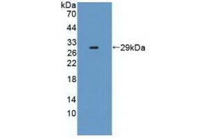 Detection of Recombinant IL2Ra, Human using Polyclonal Antibody to Interleukin 2 Receptor Alpha (IL2Ra) (CD25 Antikörper  (AA 22-213))