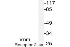 Western blot (WB) analysis of KDEL Receptor 2 antibody in extracts from HUVEC cells. (KDELR2 Antikörper)