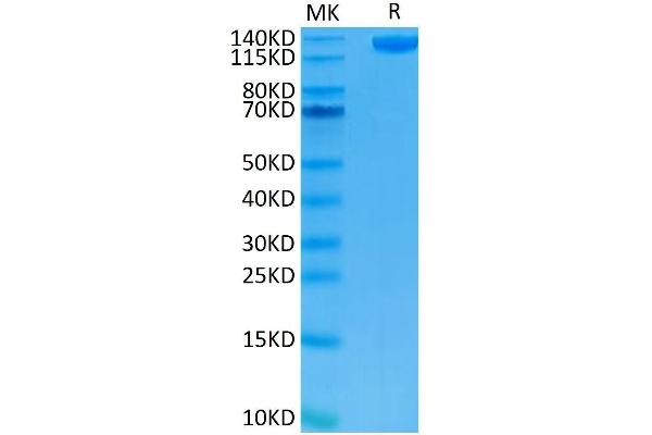 CD22 Protein (AA 20-687) (Fc Tag)