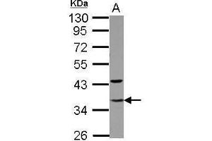 WB Image Sample (30 ug of whole cell lysate) A: Jurkat nucleus 10% SDS PAGE antibody diluted at 1:5000 (GTF2E2 Antikörper)