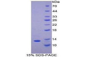 SDS-PAGE (SDS) image for Chemokine (C-C Motif) Ligand 8 (CCL8) (AA 20-94) protein (His tag) (ABIN1880052)
