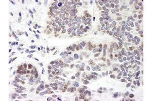 Immunohistochemistry (IHC) image for anti-Zinc Finger Protein 261 (ZMYM3) (AA 250-300) antibody (ABIN7449408)
