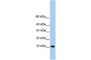 Western Blotting (WB) image for anti-Trafficking Protein Particle Complex 6B (TRAPPC6B) antibody (ABIN2459663)