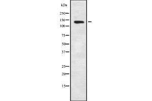 Western blot analysis of KCNT1 using K562 whole cell lysates (KCNT1 Antikörper  (C-Term))