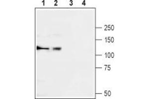Western blot analysis of rat brain (lanes 1 and 3) and human K562 chronic myelogeneous leukemia (lanes 2 and 4) lysates:1,2.