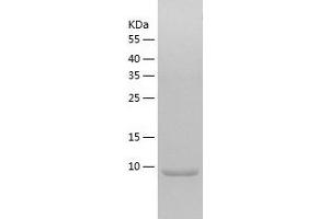 Western Blotting (WB) image for Chemokine (C-C Motif) Ligand 17 (CCL17) (AA 24-93) protein (His tag) (ABIN7288720) (CCL17 Protein (AA 24-93) (His tag))