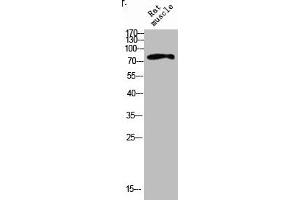 Western blot analysis of RAT-MUSLE lysis using IL4R antibody. (IL4 Receptor Antikörper  (Internal Region))