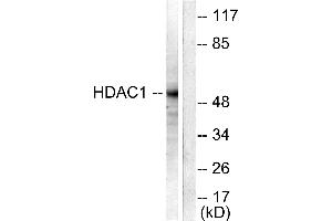 Western blot analysis of extracts from NIH/3T3 cells, using HDAC1 antibody (#C0221). (HDAC1 Antikörper)
