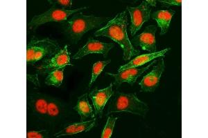 IF analysis of Cyclophilin E/PPIE using anti-Cyclophilin E/PPIE antibody (ABIN7599242). (PPIE Antikörper  (AA 1-301))