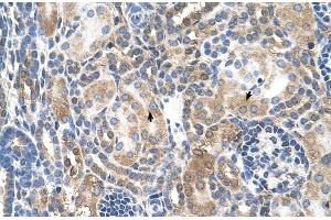 Immunohistochemistry (IHC) image for anti-Nuclear Receptor Subfamily 3, Group C, Member 2 (NR3C2) (Middle Region) antibody (ABIN2773864)