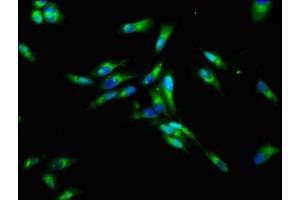 Immunofluorescence staining of Hela cells with ABIN7161356 at 1:133, counter-stained with DAPI. (CHRNB3 Antikörper  (AA 67-218))