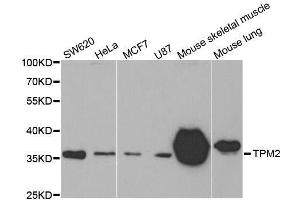 Western blot analysis of extracts of various cell lines, using TPM2 antibody. (TPM2 Antikörper)