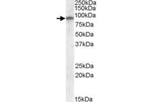 GRIA4 polyclonal antibody  (0. (GRIA4 Antikörper)