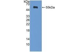 Detection of Recombinant DIAPH1, Human using Polyclonal Antibody to Diaphanous Homolog 1 (DIAPH1) (DIAPH1 Antikörper  (AA 389-583))