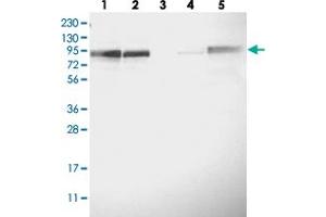 Western blot analysis of Lane 1: RT-4, Lane 2: U-251 MG, Lane 3: Human Plasma, Lane 4: Liver, Lane 5: Tonsil with FAM129B polyclonal antibody  at 1:250-1:500 dilution. (MEG3 Antikörper)