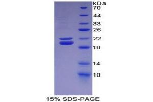 SDS-PAGE (SDS) image for Haptoglobin (HP) ELISA Kit (ABIN6574216)