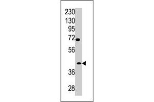 Western blot analysis of TPST2 polyclonal antibody  in A2058 cell line lysate (35 ug/lane). (TPST2 Antikörper  (C-Term))