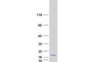 Validation with Western Blot (MCFD2 Protein (Myc-DYKDDDDK Tag))