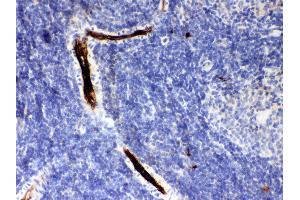Anti- SERPINA1 Picoband antibody, IHC(P) IHC(P): Rat Spleen Tissue (SERPINA1 Antikörper  (AA 211-411))