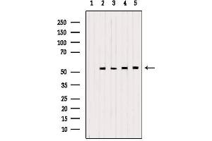 Western blot analysis of extracts from various samples, using PDHX Antibody. (PDHX Antikörper)